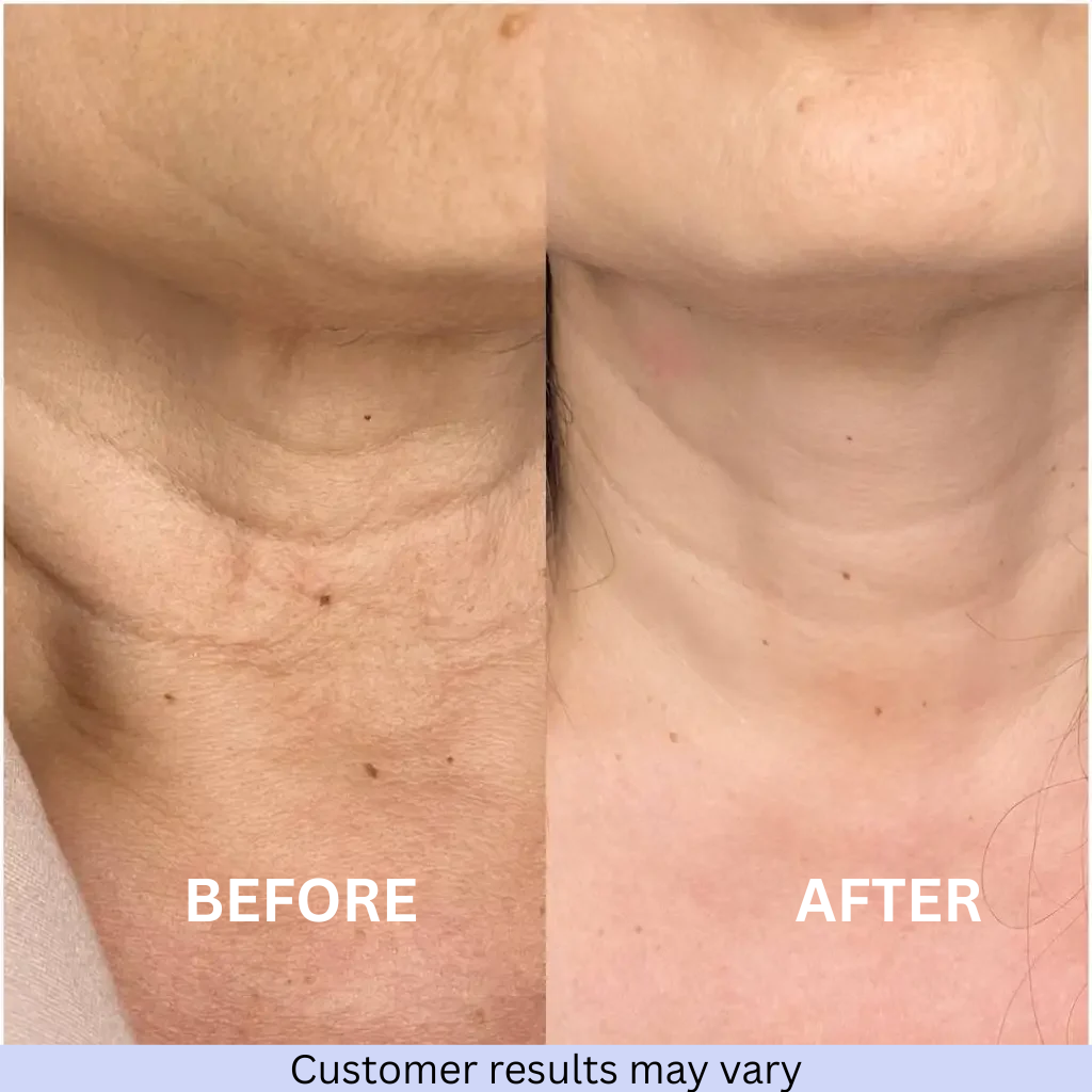 Firming & Lifting Neck Treatment Cream